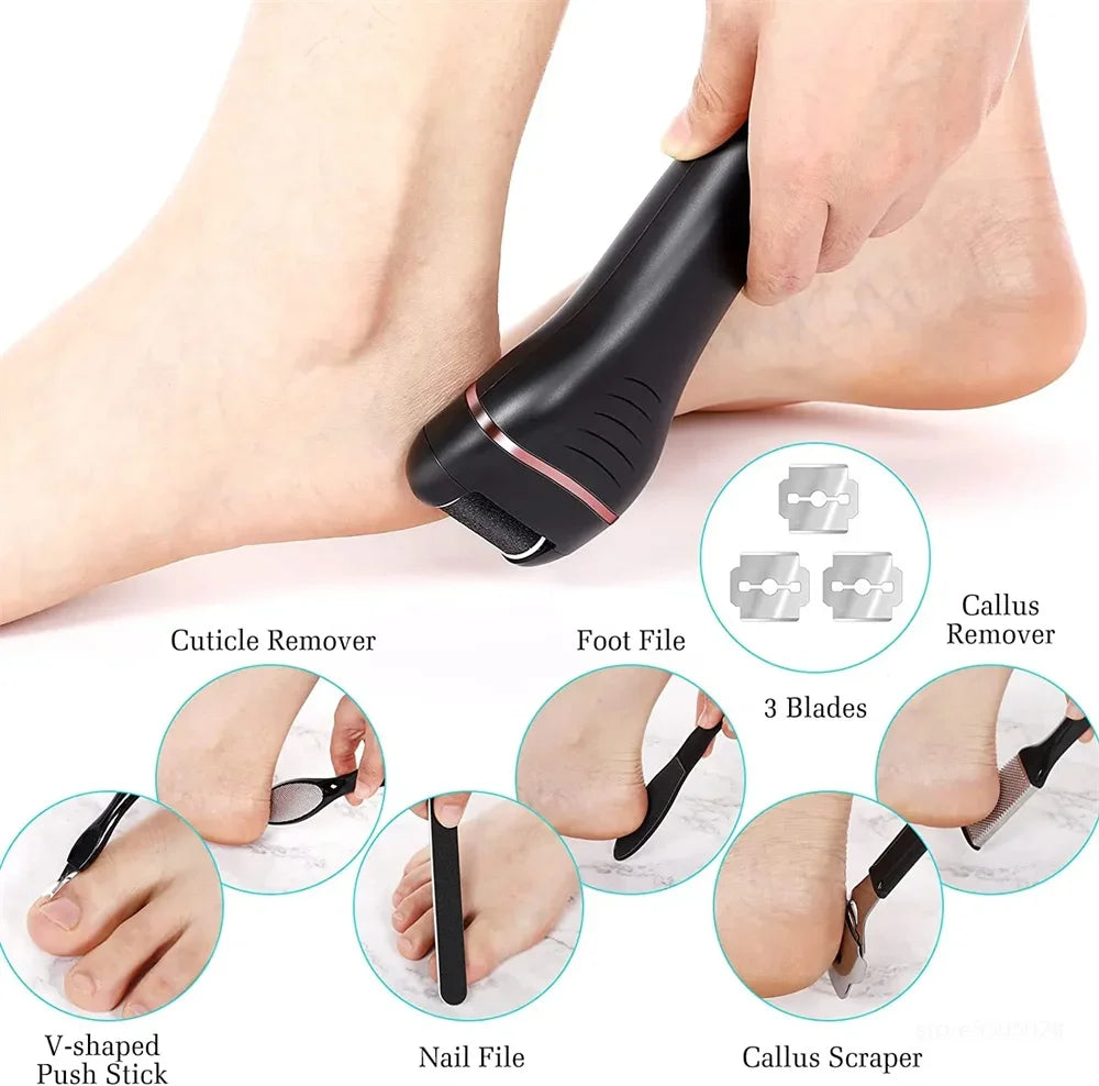 HeelHero™ – Say Goodbye to Cracked Heels & Dead Skin!